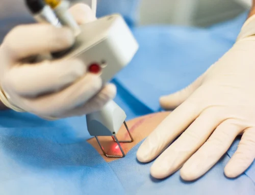 Why More People Are Choosing Laser Scar Removal in Lakewood Ranch, FL for Healthier Looking Skin